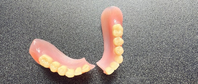 broken denture