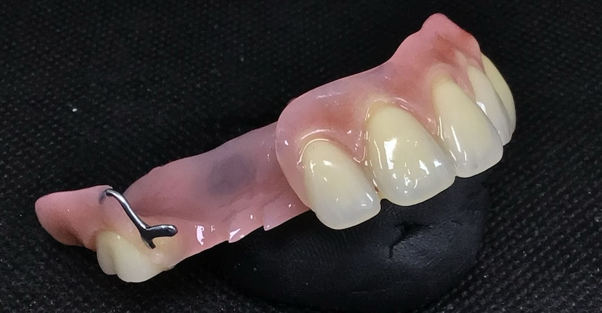 partial denture