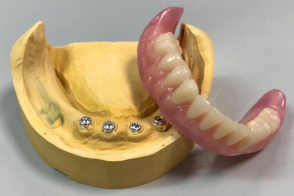 broken denture