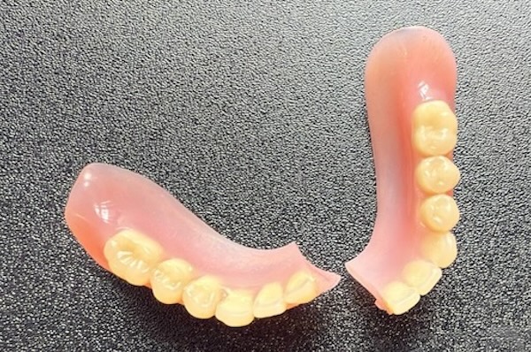 denture repair