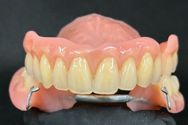 partial denture