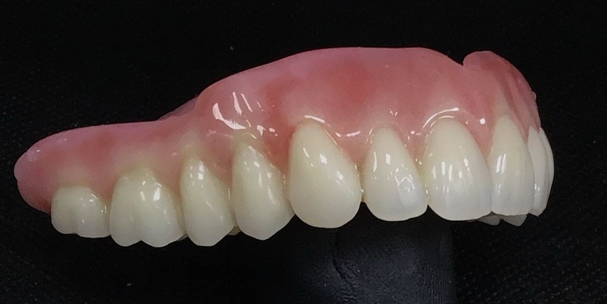 suction denture top set